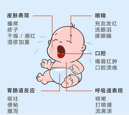 家有小小“过敏星人”入园准备需从0岁开始